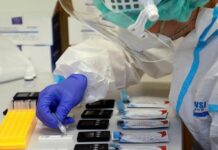 Anggota Komisi V DPRD Lampung Jalani Rapid Test Antigen